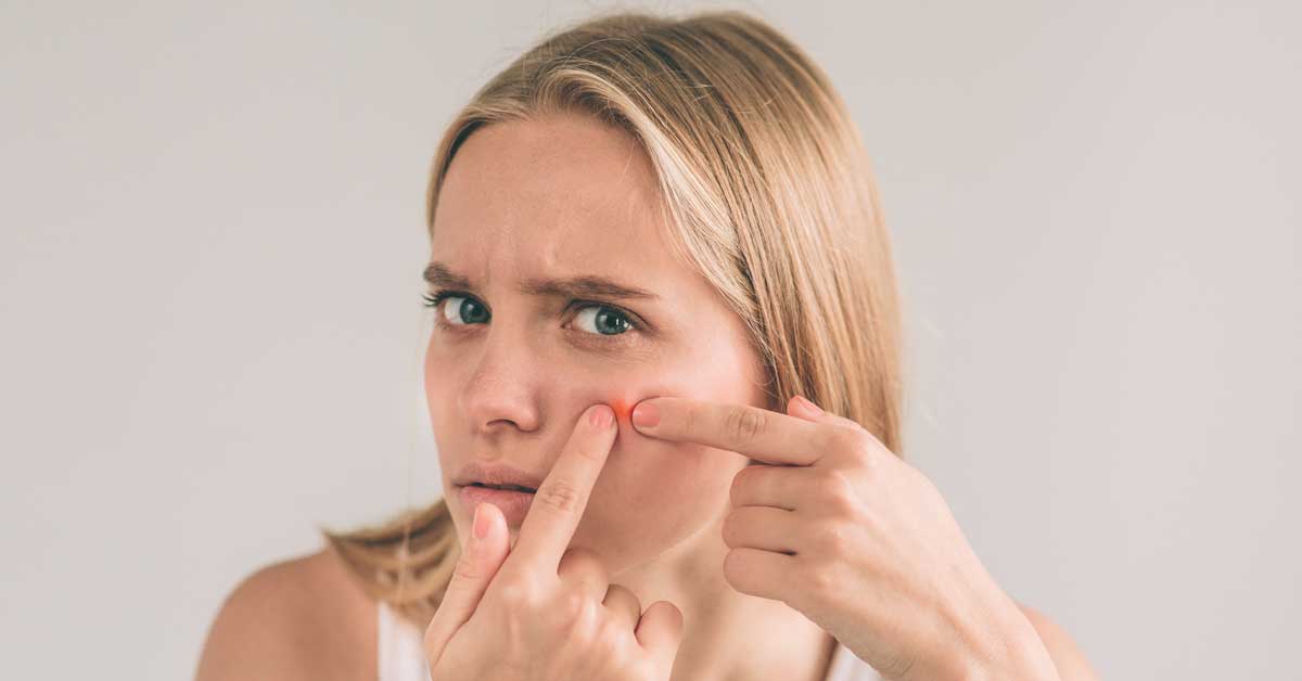  Sprečite bubuljice pred menstruaciju. Jednostavno je!