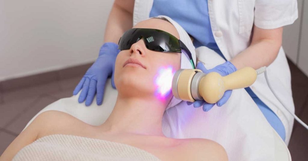 laser za akne