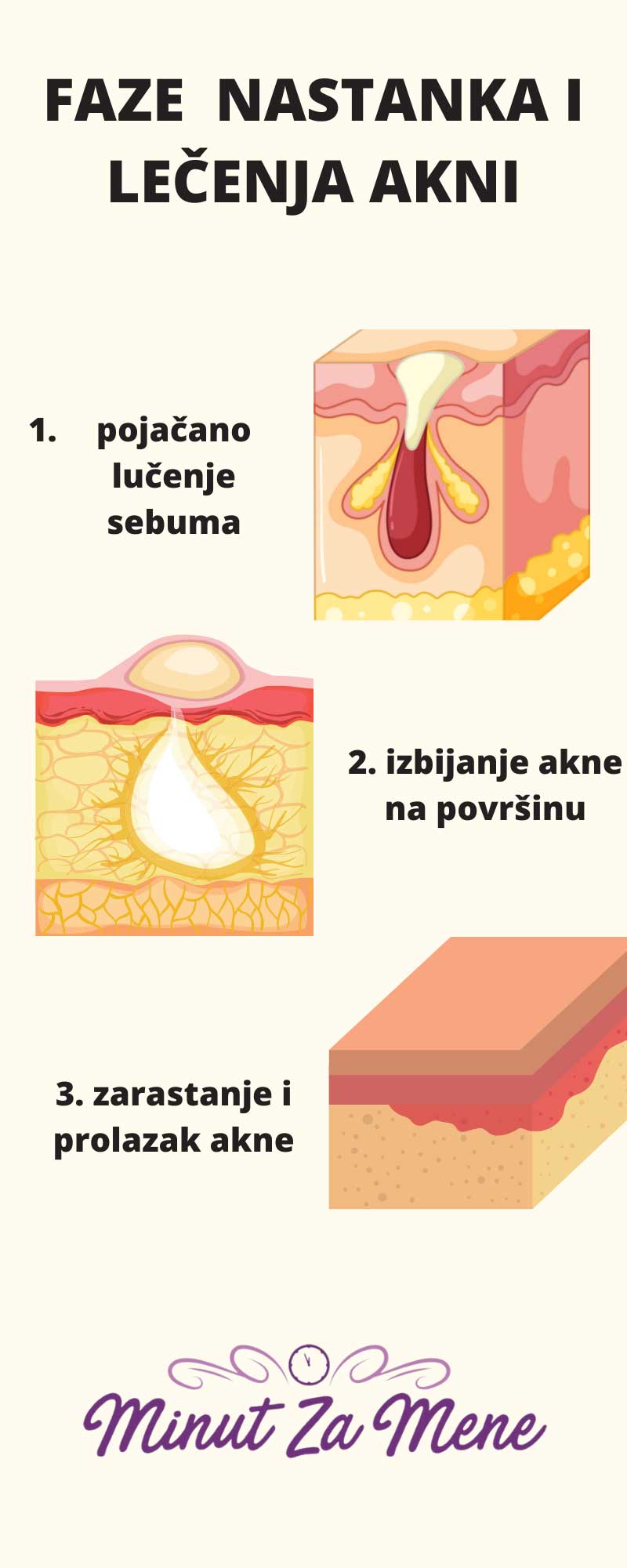 lečenje akni proces