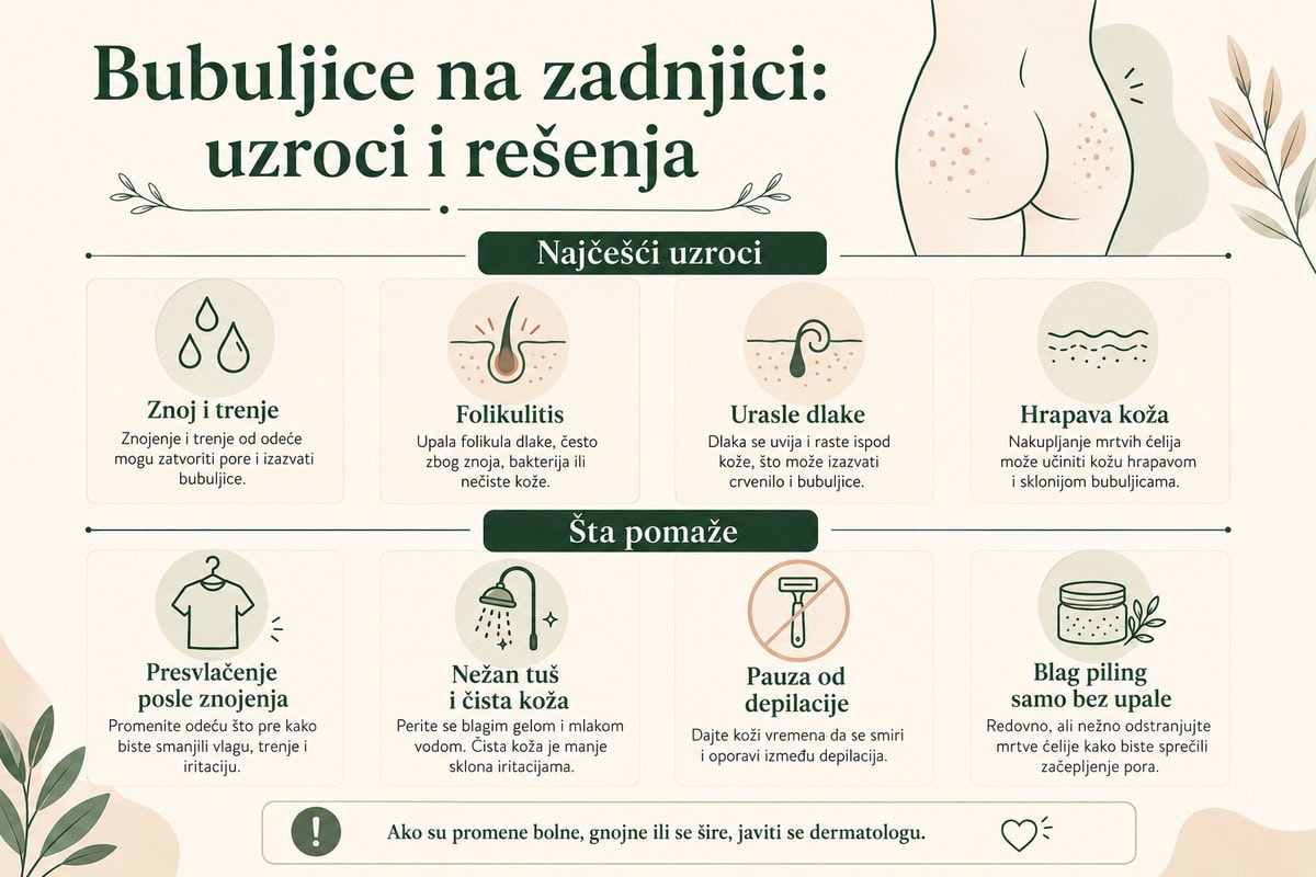 bubuljice na zadnjici